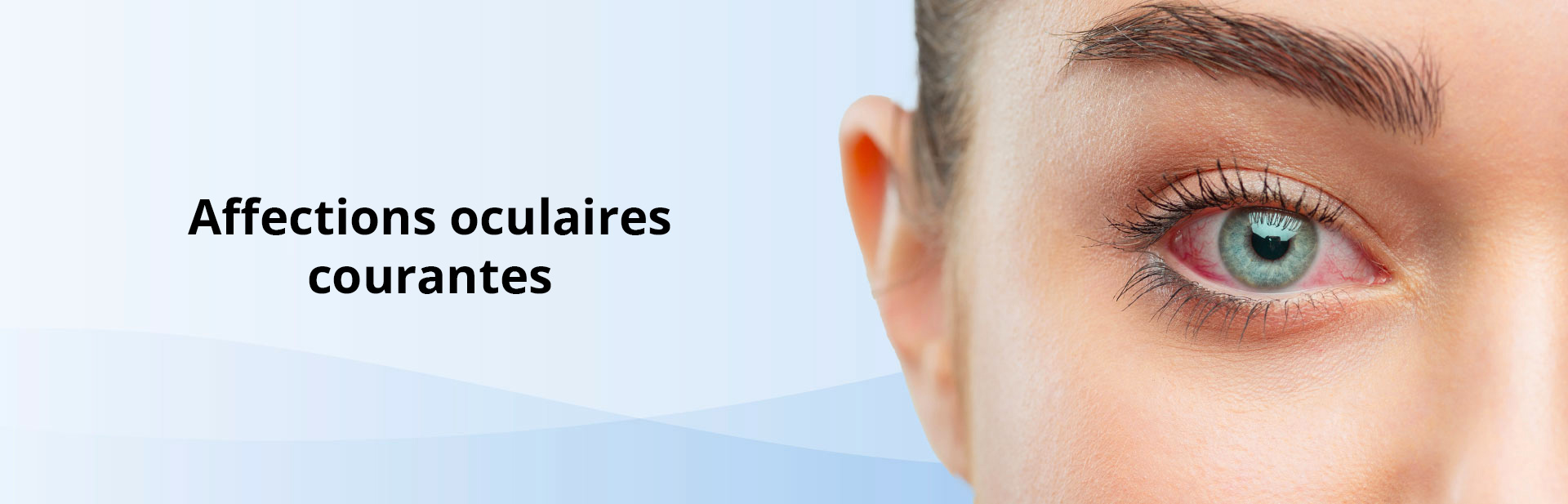 Common eye conditions banner