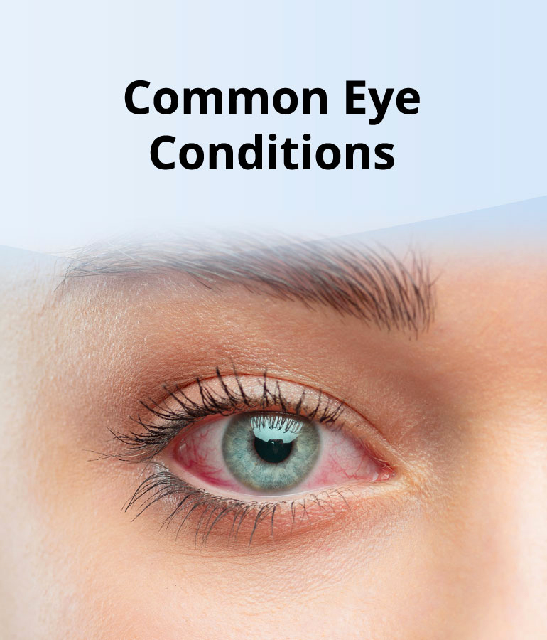 Common eye conditions banner