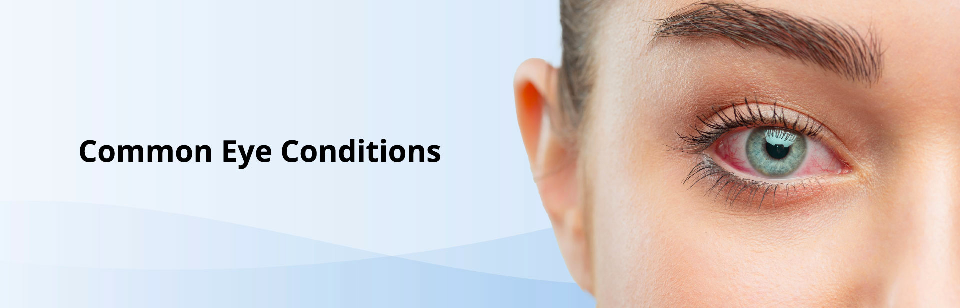 Common eye conditions banner