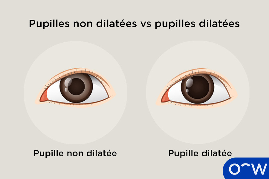 Examen de la vue avec dilatation des pupilles