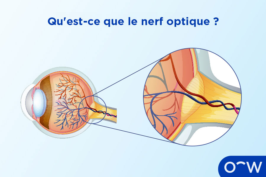 Une section transversale d'un œil, illustrant l'emplacement du nerf optique au fond de l'œil, et une image en gros plan du nerf optique montrant cette structure plus en détail.