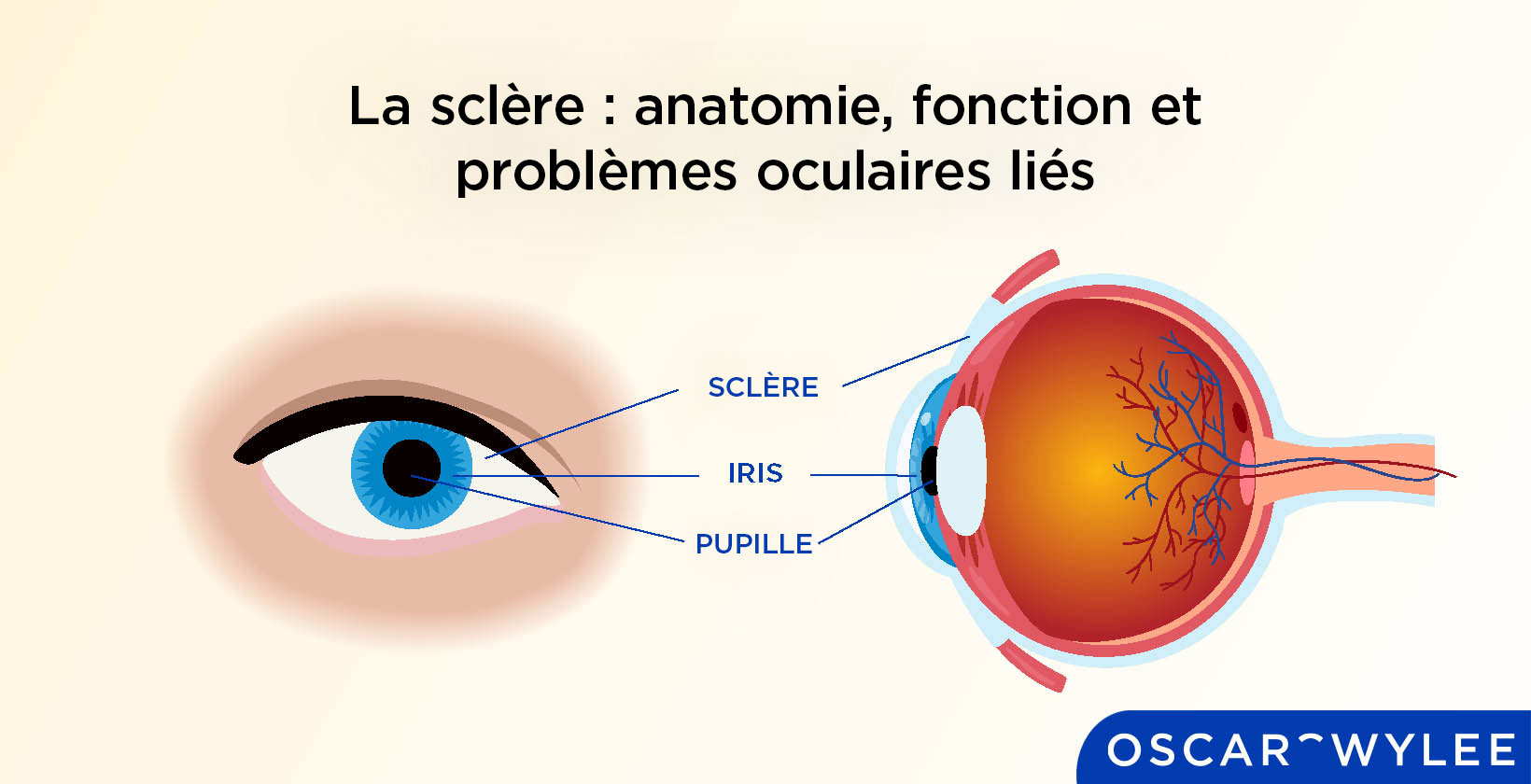 Sclère de l’œil 