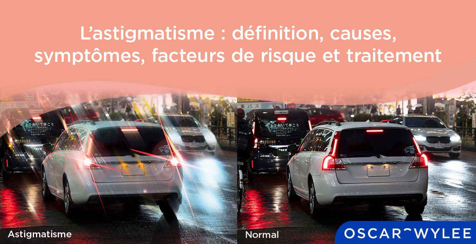 L’astigmatisme : causes, facteurs de risque et traitement