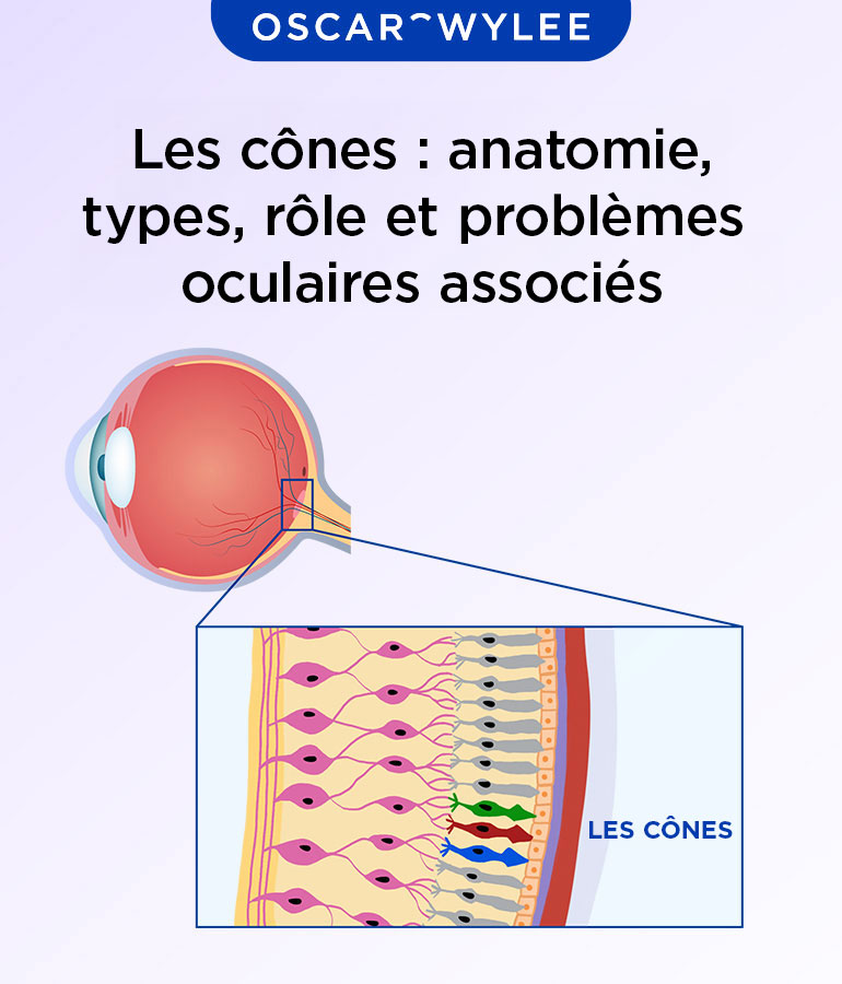 Les cônes