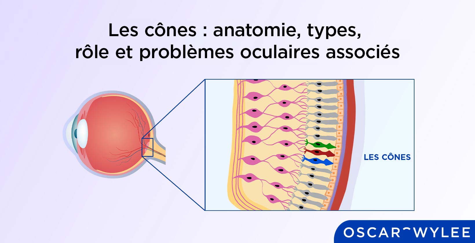 Les cônes