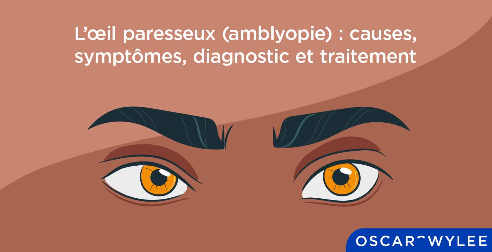 L’œil paresseux (amblyopie) : causes, symptômes, diagnostic et traitement