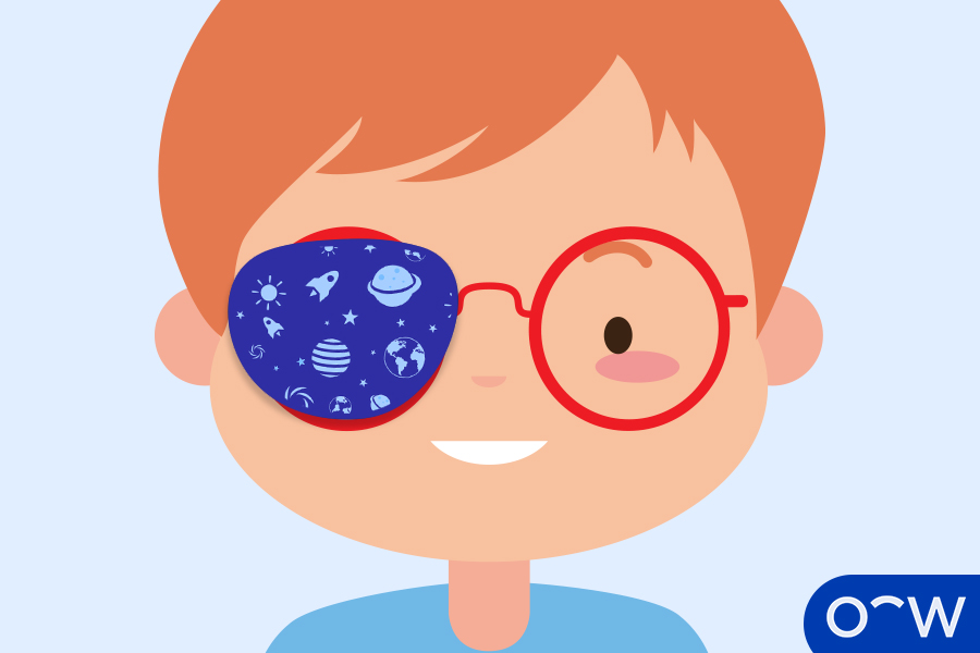 L’œil paresseux (amblyopie) : causes, symptômes, diagnostic et traitement