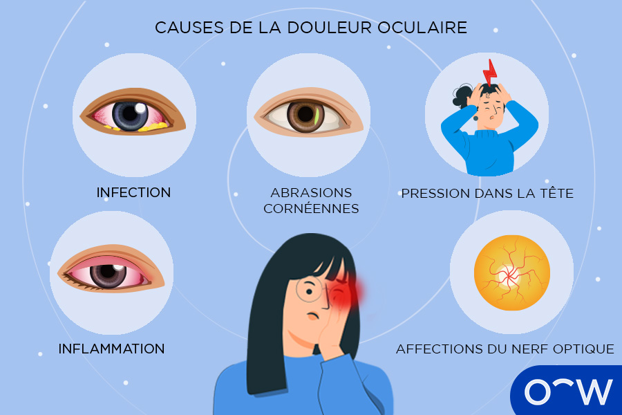 Illustrations graphiques montrant les différentes causes de la douleur oculaire.