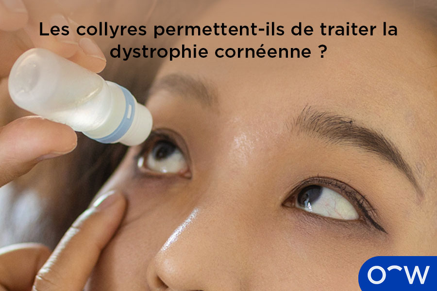 Une personne utilisant des collyres pour traiter une dystrophie cornéenne.