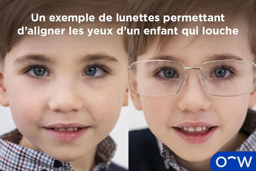 Un exemple de lunettes permettant d'aligner les yeux d'un enfant qui louche.