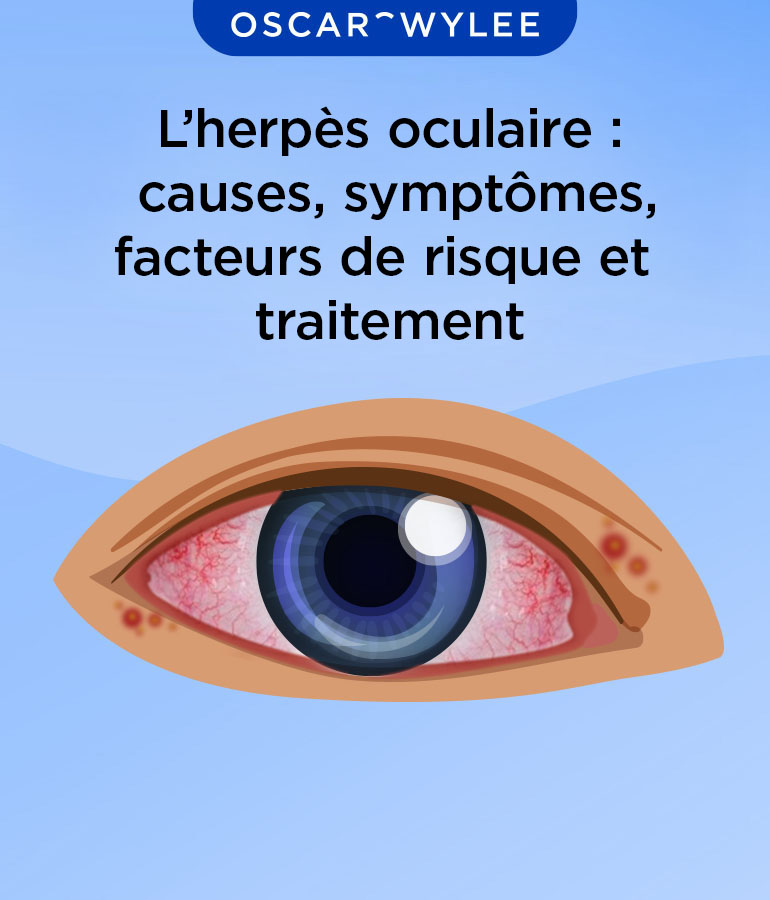 Symptômes, traitement et causes de l’herpès oculaire