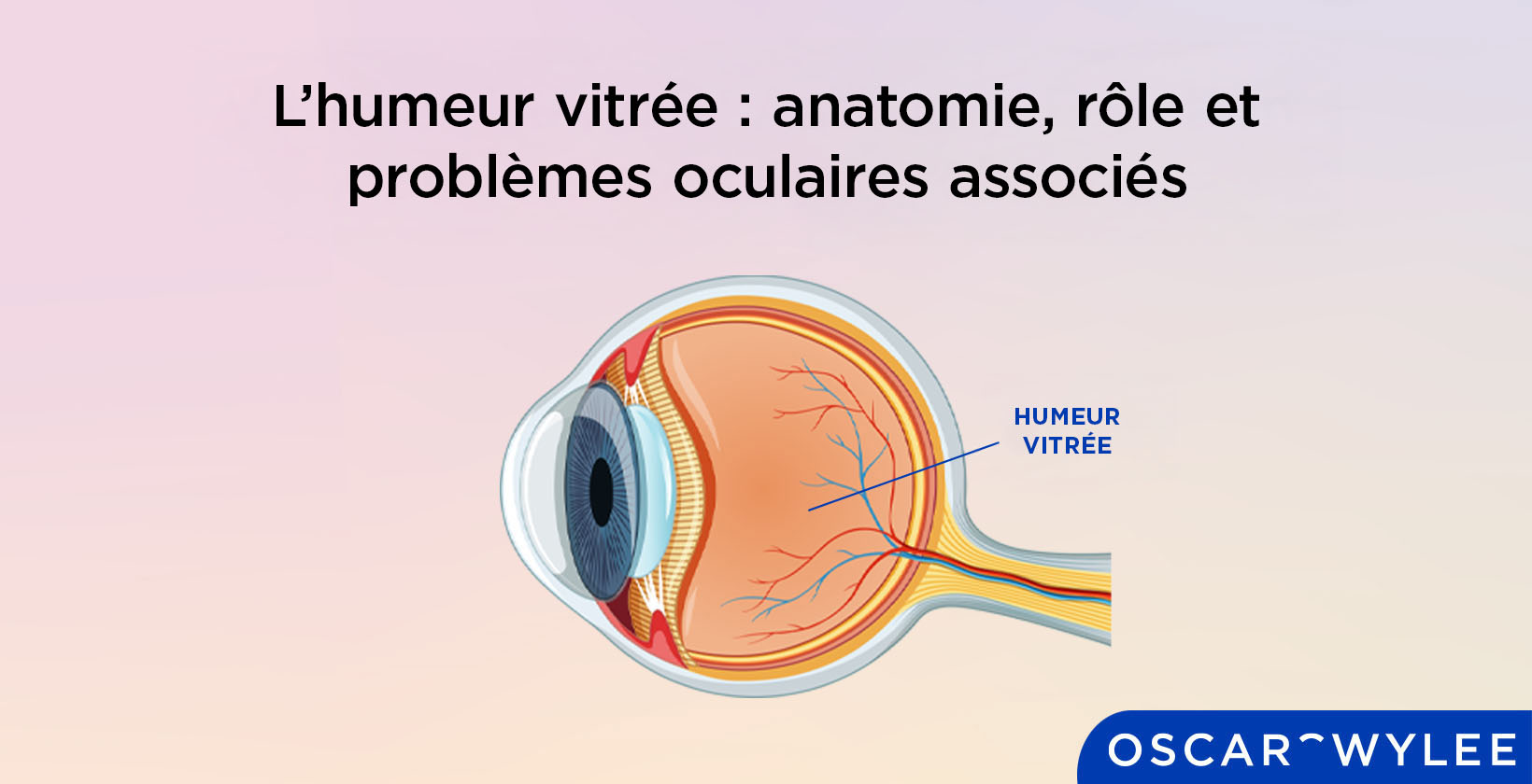  L’humeur vitrée.