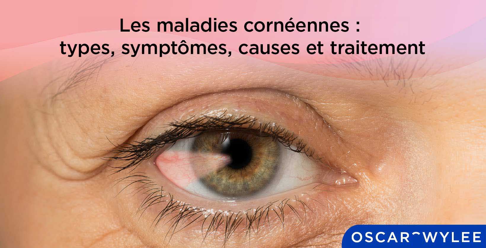 Les maladies cornéennes
