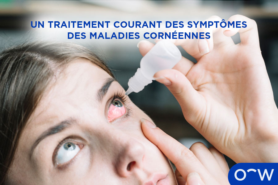 Une personne utilisant des collyres pour traiter une maladie cornéenne.