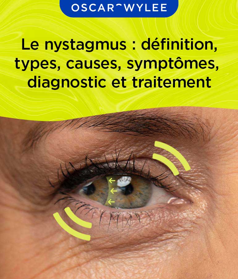 Le nystagmus : définition, types, causes, symptômes, diagnostic et traitement