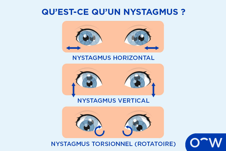 L'image montre les yeux d'un homme pointant dans des directions différentes