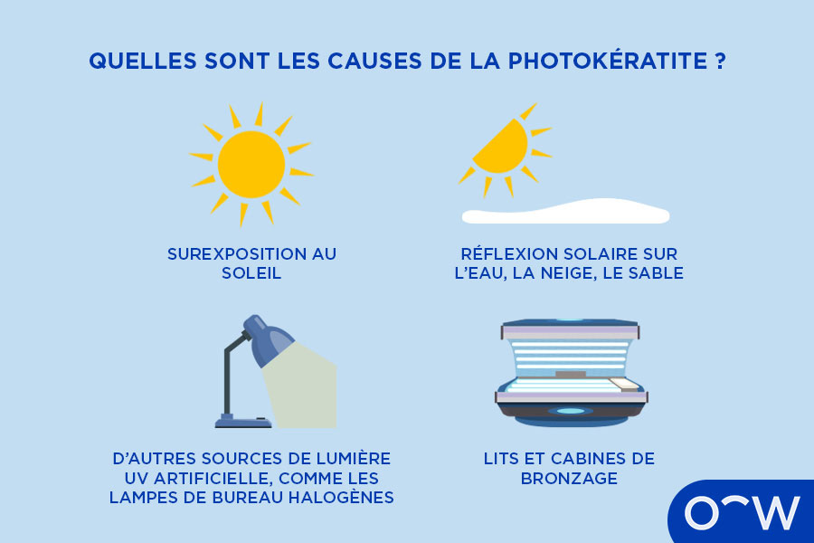 Illustration montrant les différentes causes de la photokératite.