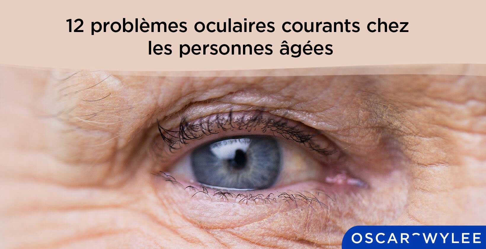 Problèmes oculaires courants chez les personnes âgées