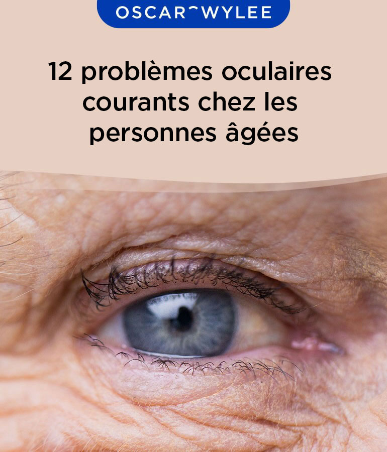 Problèmes oculaires courants chez les personnes âgées