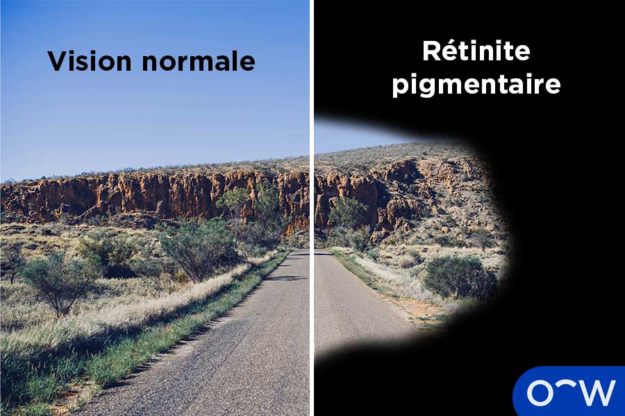 La première partie de l'image montre une vue normale de la route, alors que la seconde partie montre une vue de la route avec une vision en tunnel.