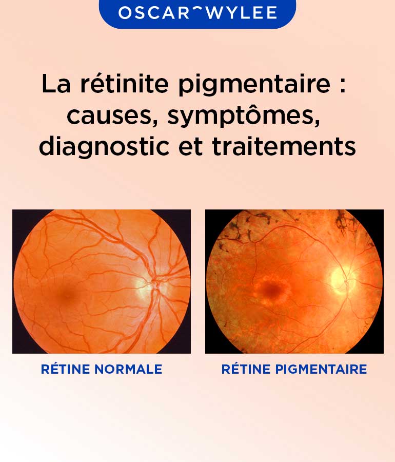 La rétinite pigmentaire.