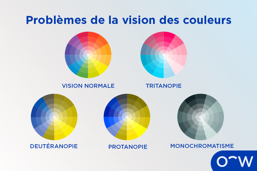 Les différents types de daltonisme résultant de la rétinite pigmentaire
