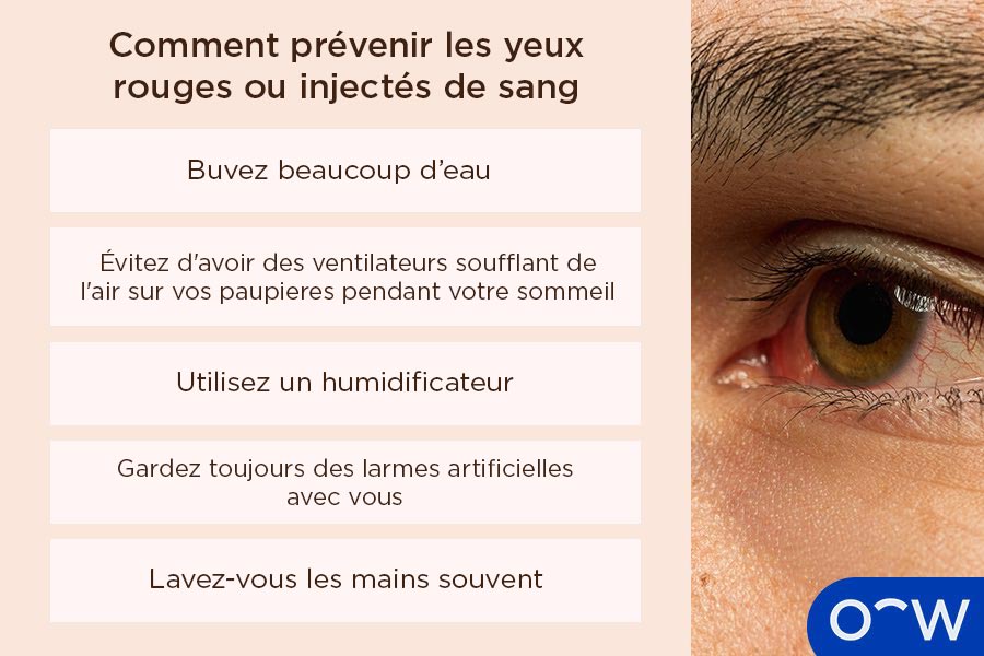 Comment prévenir les yeux rouges ou injectés de sang