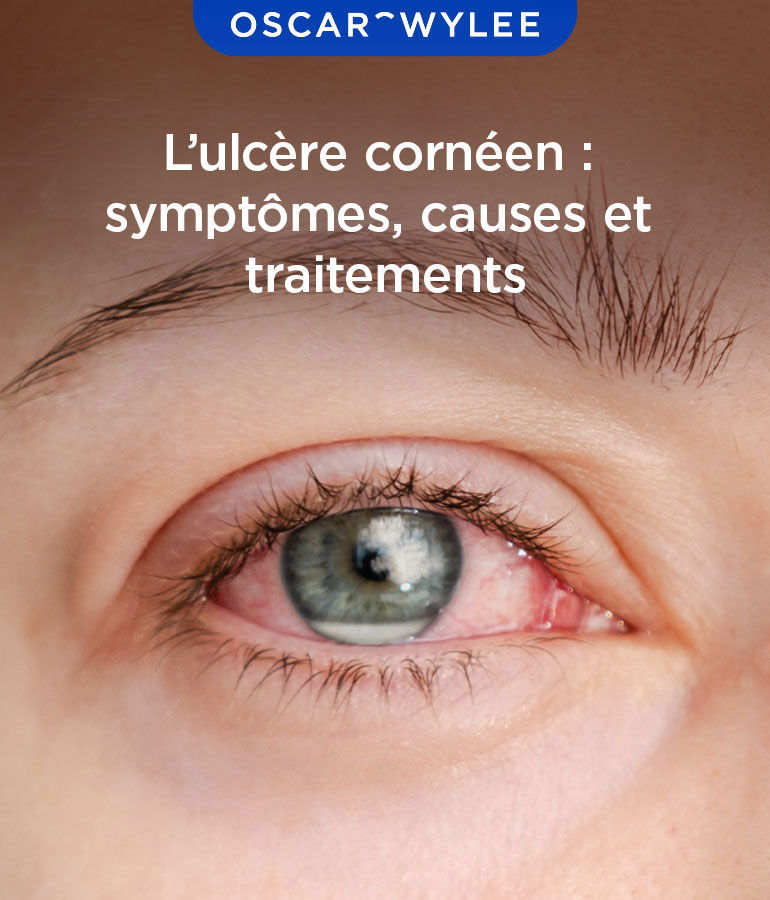 L’ulcère cornéen 