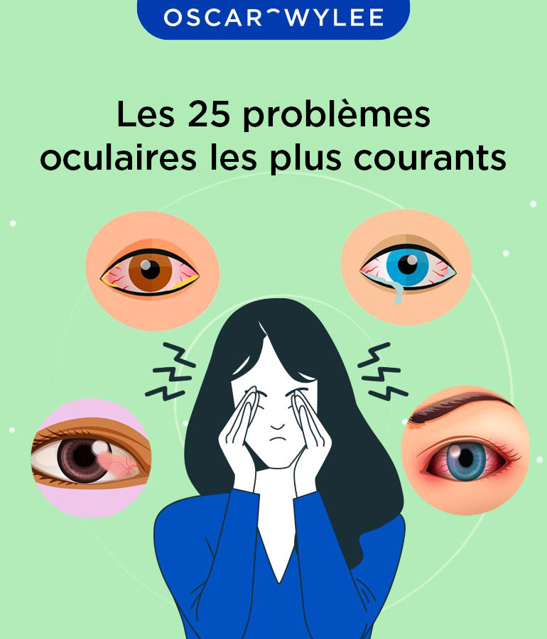 Les 25 problèmes oculaires les plus courants — free download