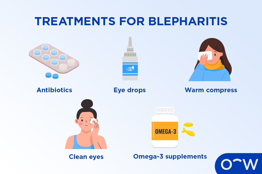 Blepharitis Types, Causes, Symptoms, Diagnosis, and Treatments