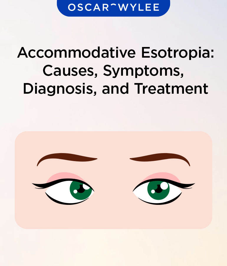 Accommodative Esotropia.