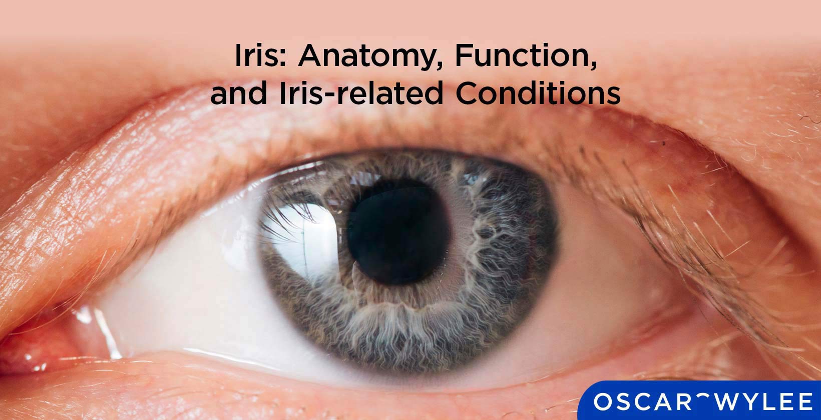 Iris Function