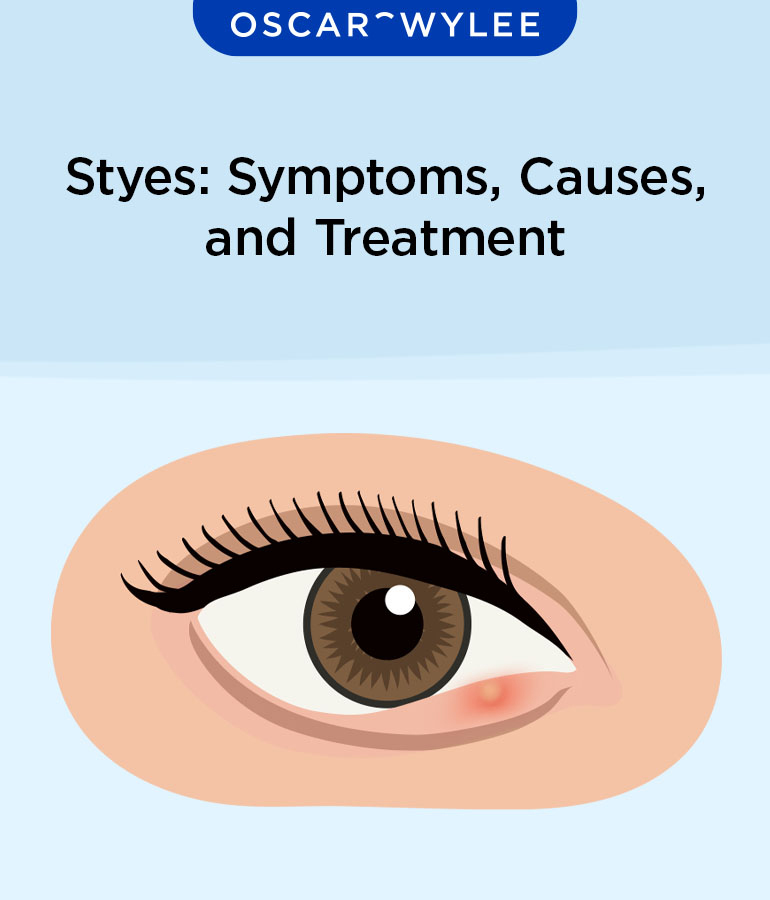Stye Eye