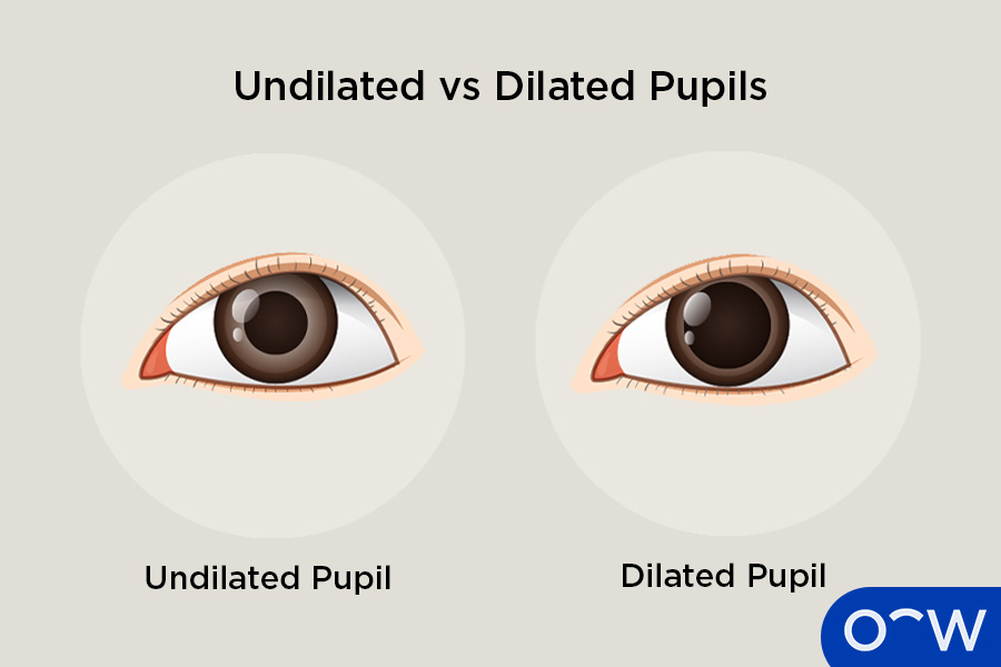 Dilated Pupil Exam