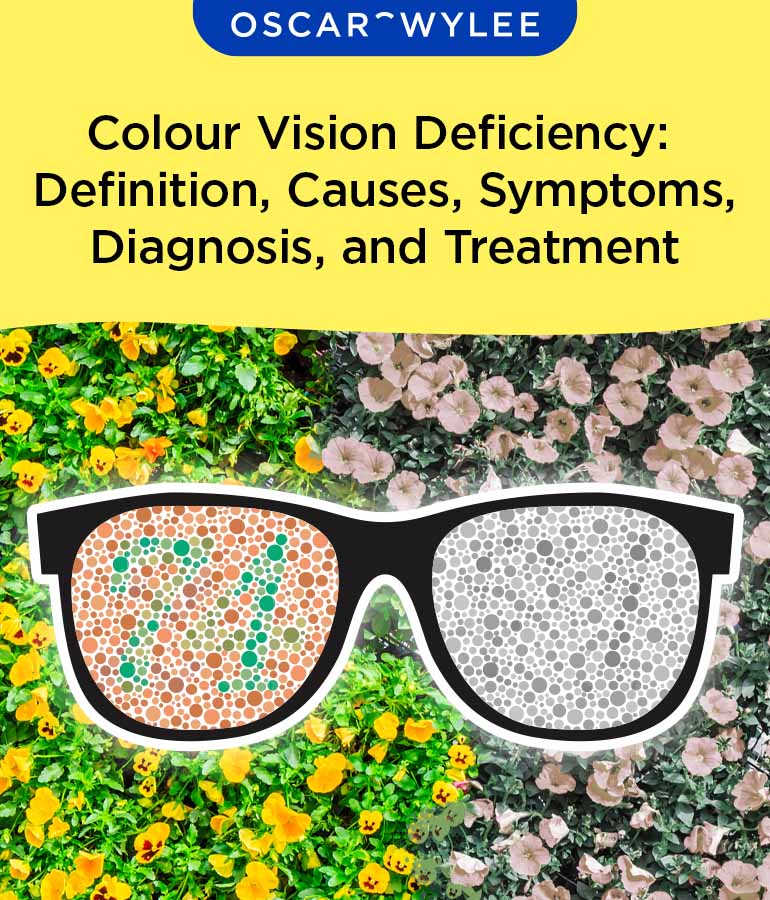 Colour Vision Deficiency.