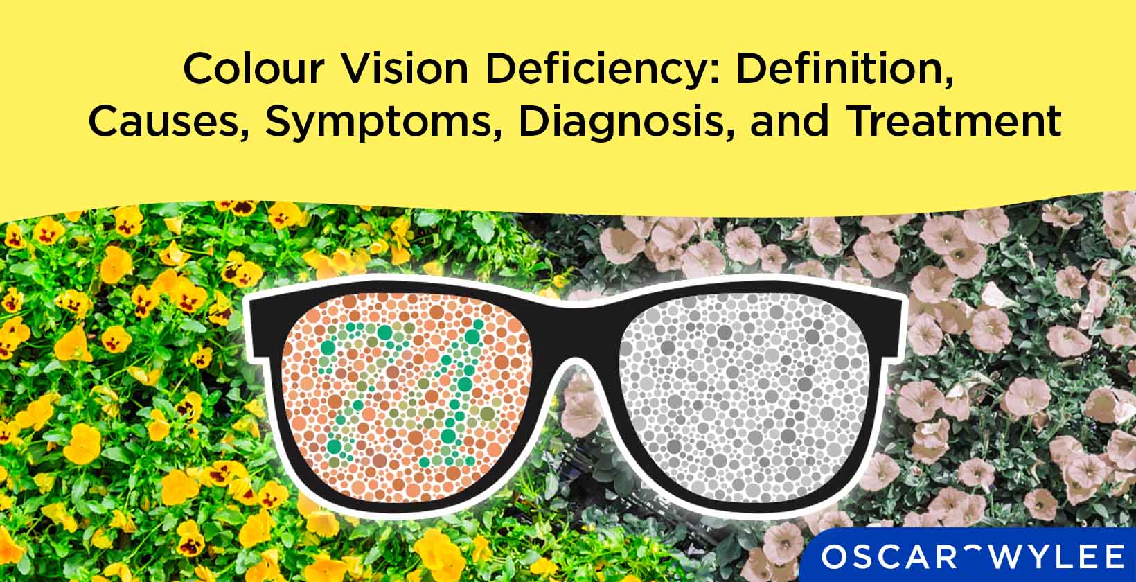 Colour Vision Deficiency.