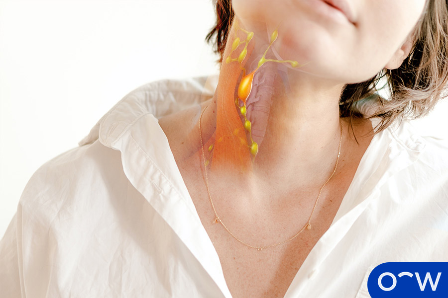 A person's neck with a drawing overlay of what lymph nodes look like under the skin.