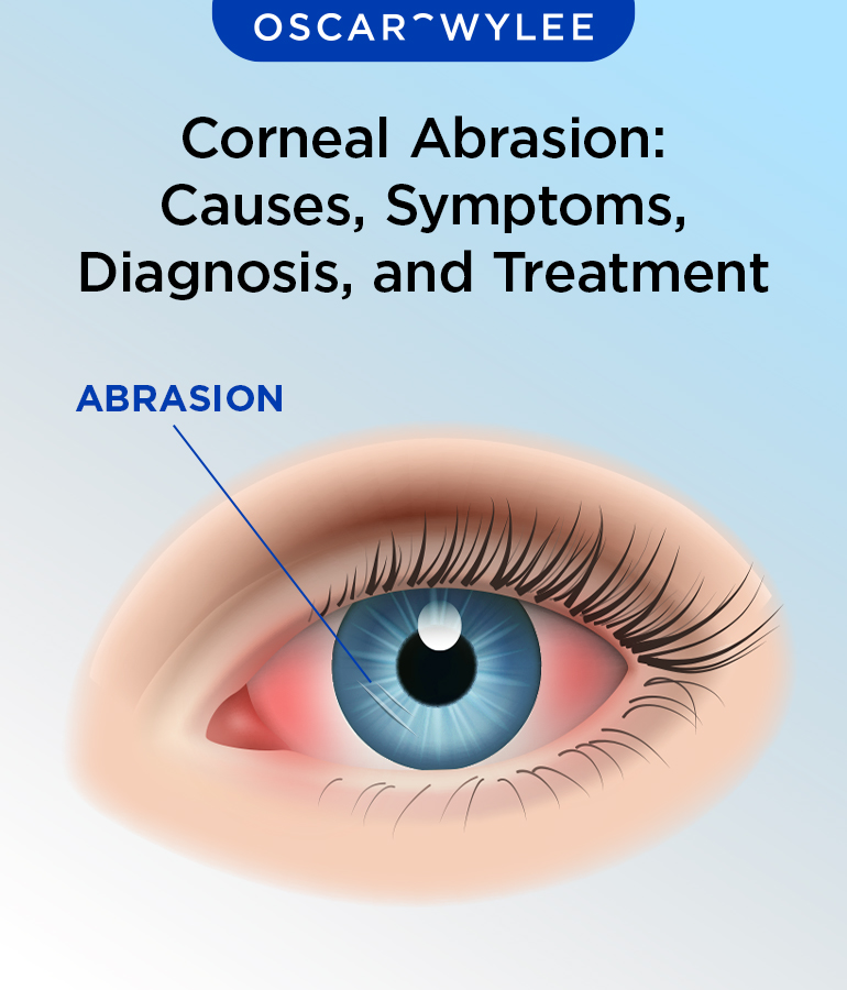 Corneal Abrasion Causes Symptoms Diagnosis And Treatment