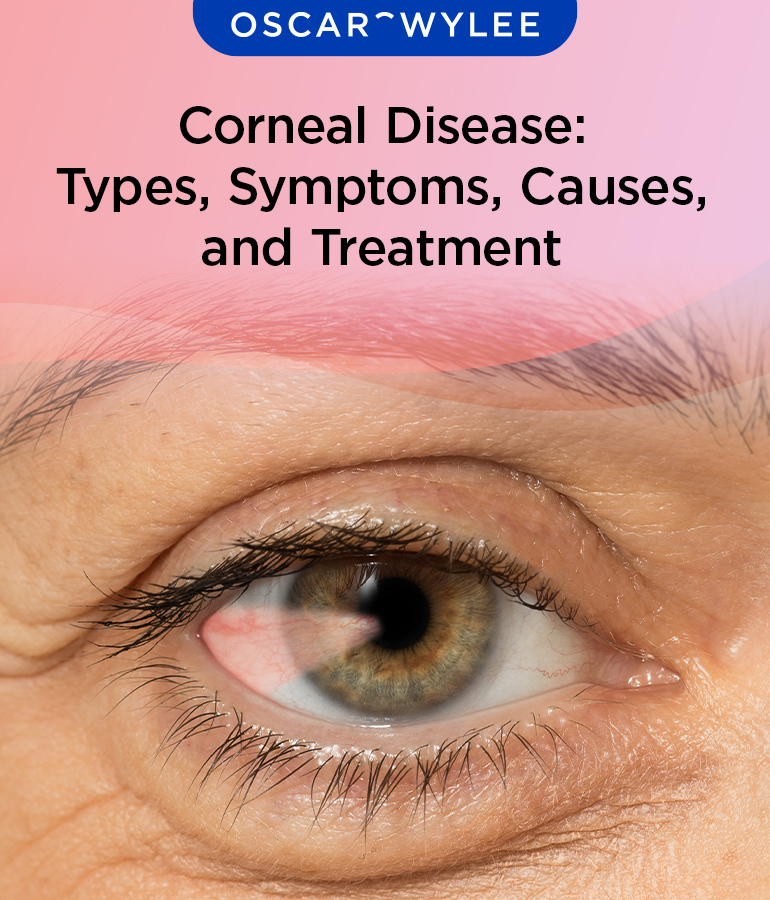 Corneal Diseases