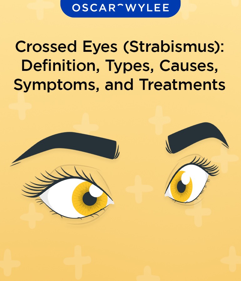 Crossed Eyes (Strabismus): Definition, Types, Causes, Symptoms, and Treatments.
