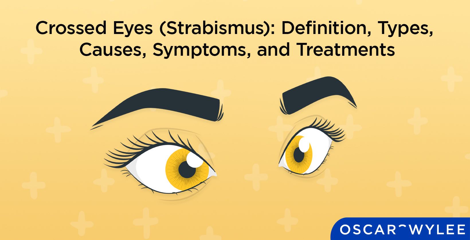 Crossed Eyes (Strabismus): Definition, Types, Causes, Symptoms, and Treatments.