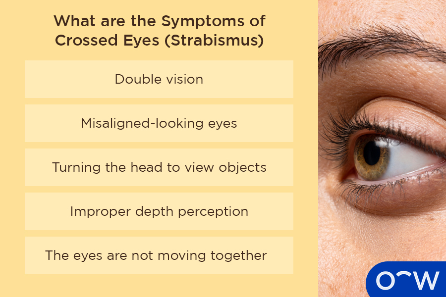 What are the Symptoms of Crossed Eyes (Strabismus)?
