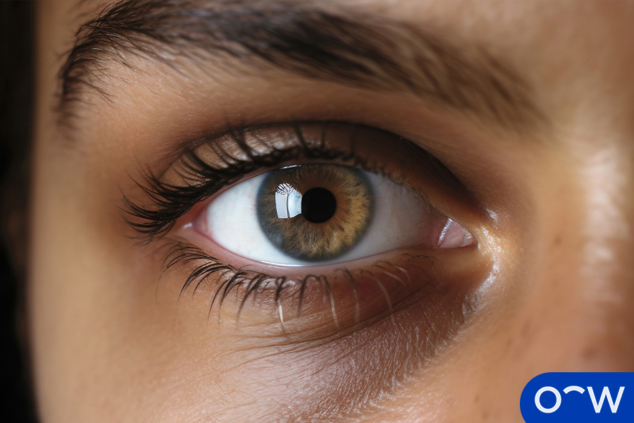 Image shows a close-up of hazel-coloured eyes