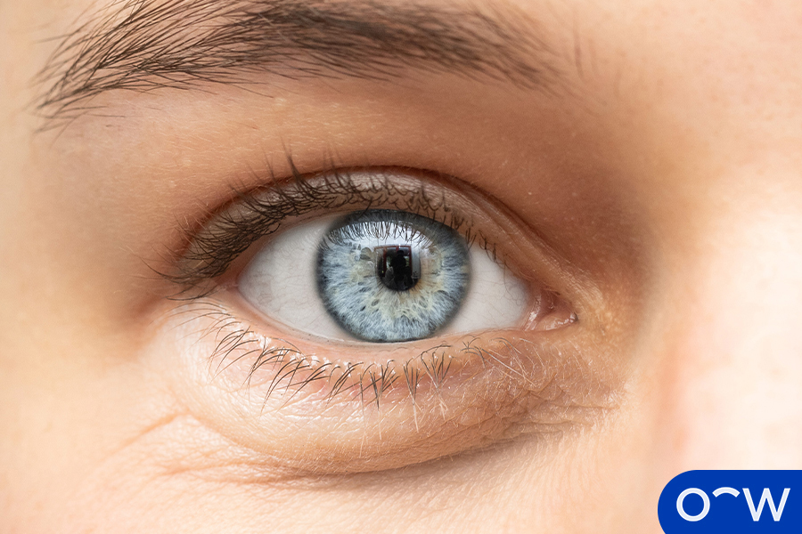Image shows a woman with blue eyes