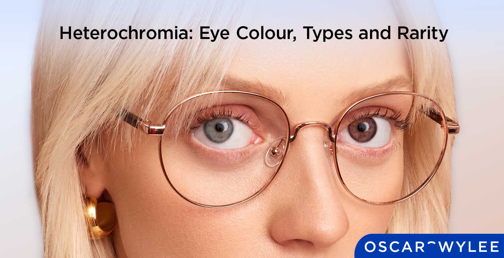 What Is Heterochromia?