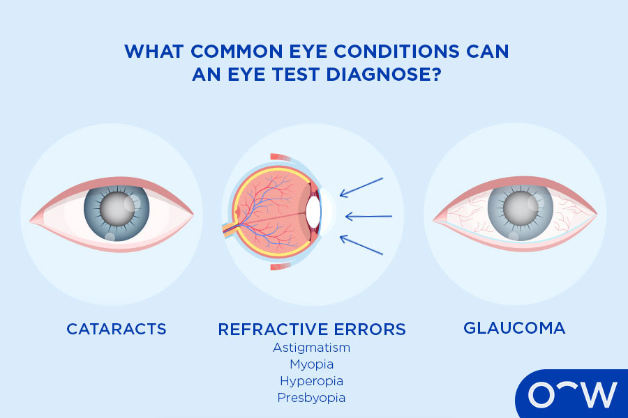 An illustration of three eyes, one with glaucoma, one with a refractive error and one with cataracts, demonstrating some of the eye conditions and eye exam can diagnose.
