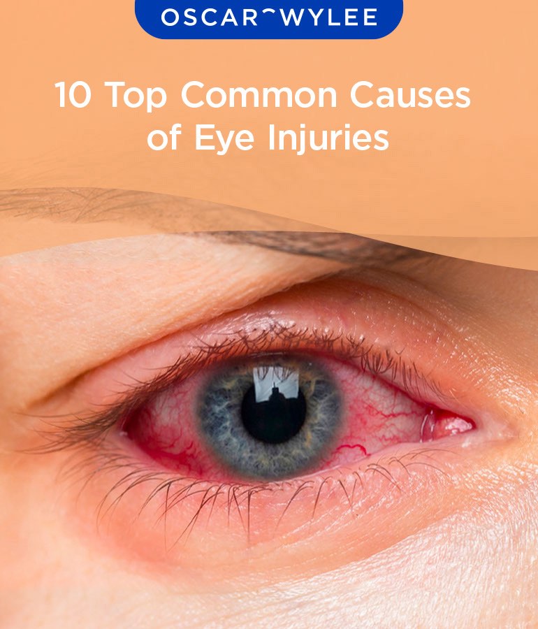 Top Causes of Eye Injuries