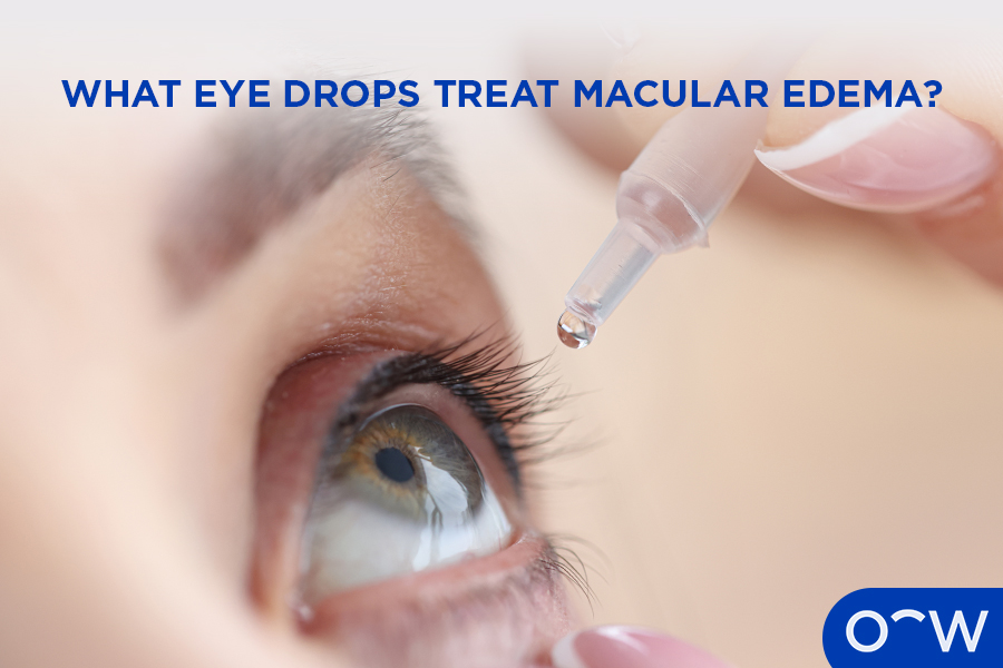 A person putting eye drops to help treat macular edema in the eye.