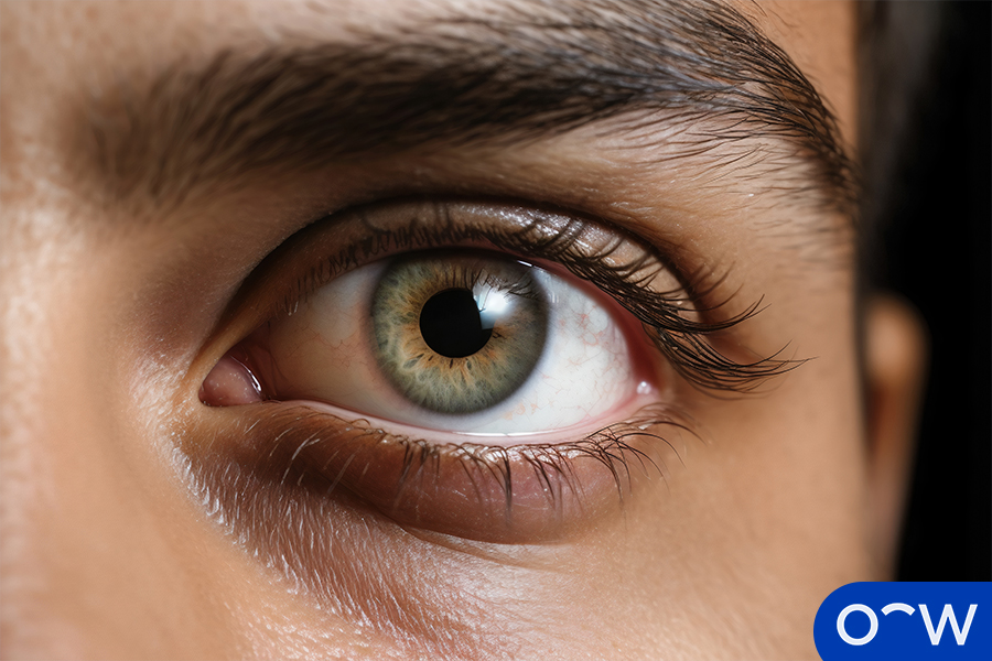 A close-up of an eye.