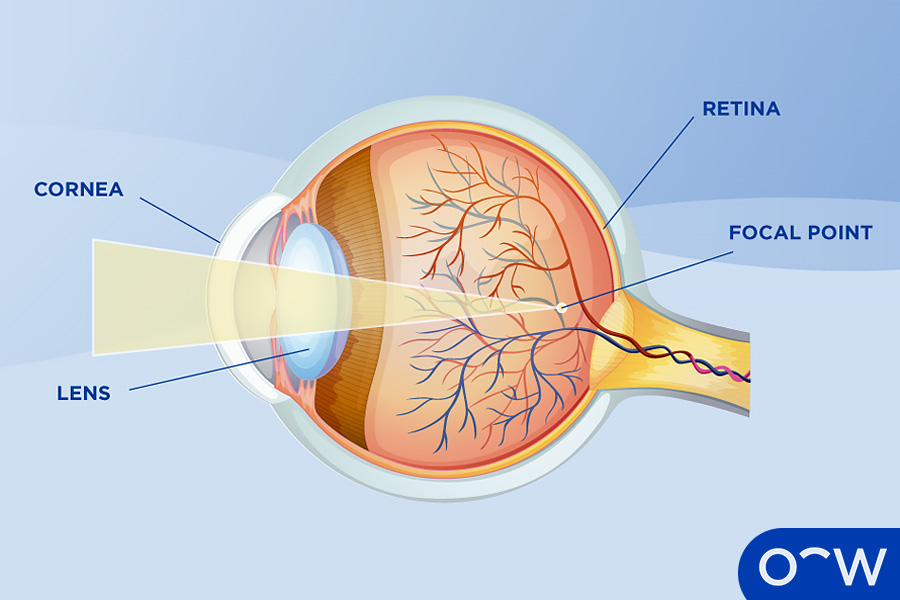 Nearsightedness definition